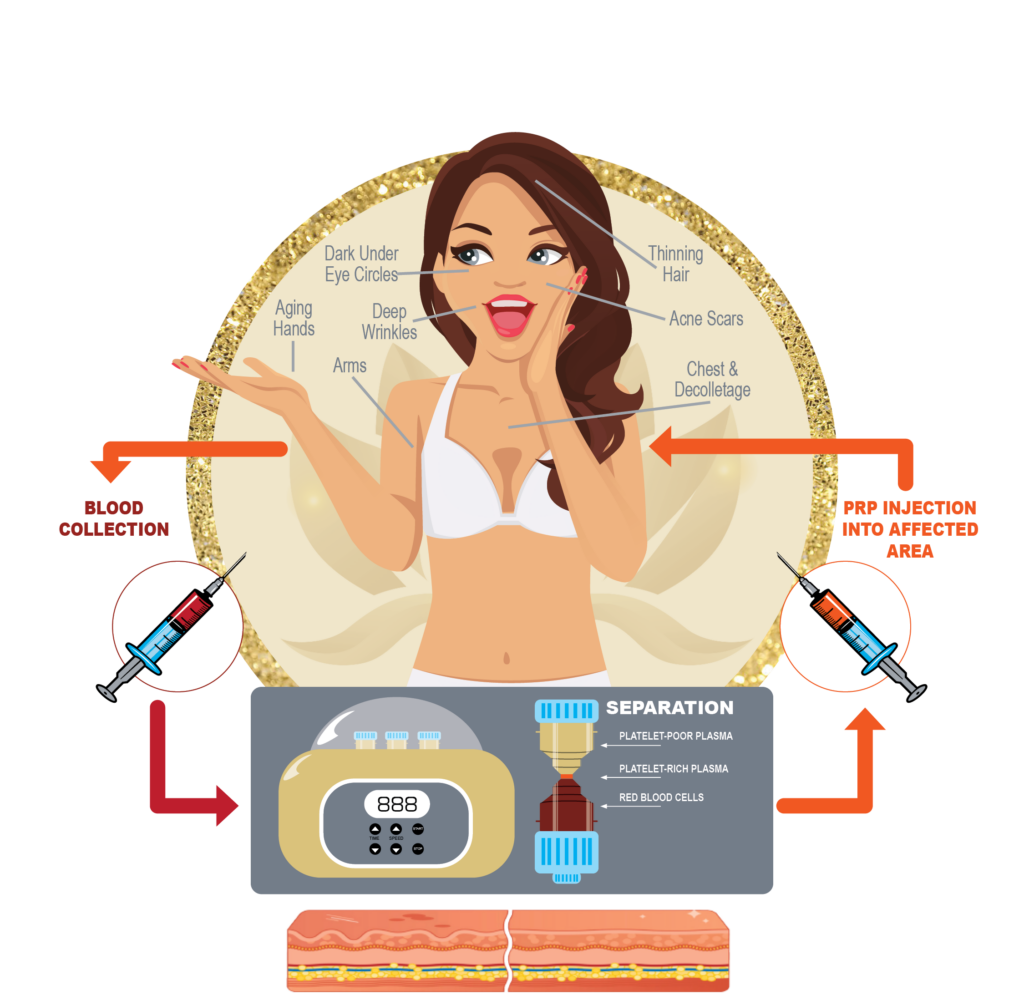 PRP Springs Body Sculpting