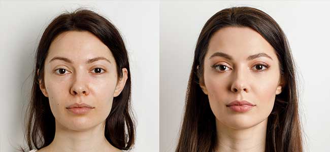before-after-clearrf-2